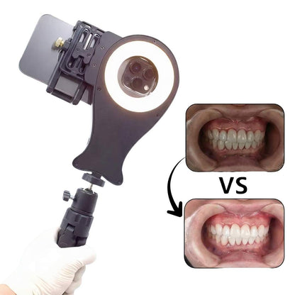 Soporte para Fotografía Oral V4 – compatible con cualquier modelo de iPhone y Android