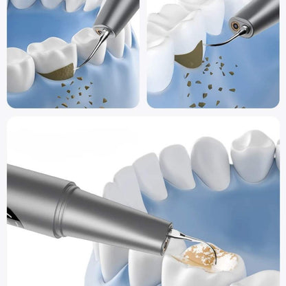 Limpiador dental ultrasónico con cámara HD y luz LED - Madicaza